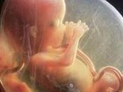 临沂市妇幼保健院做三代试管成功率如何？一文读懂需要花多少钱