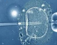 做了结扎手术可以在嵊州市试管医院做试管婴儿吗？费用是多少