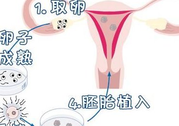 合肥三代试管婴儿的四大优势；降低遗传病风险、成功率更高！